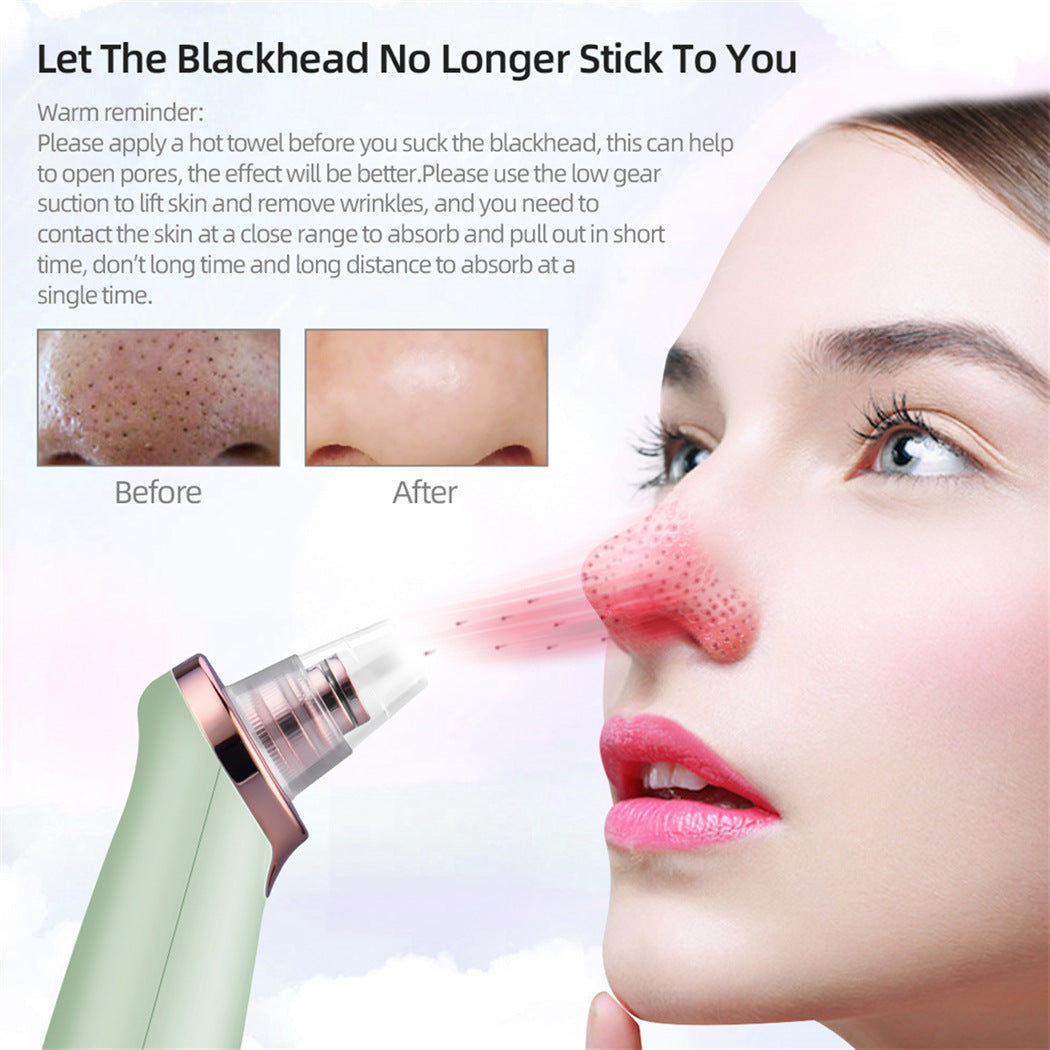 Blackhead Suction Beauty machine Electric blackhead removal pore cleaner Acne exhaler