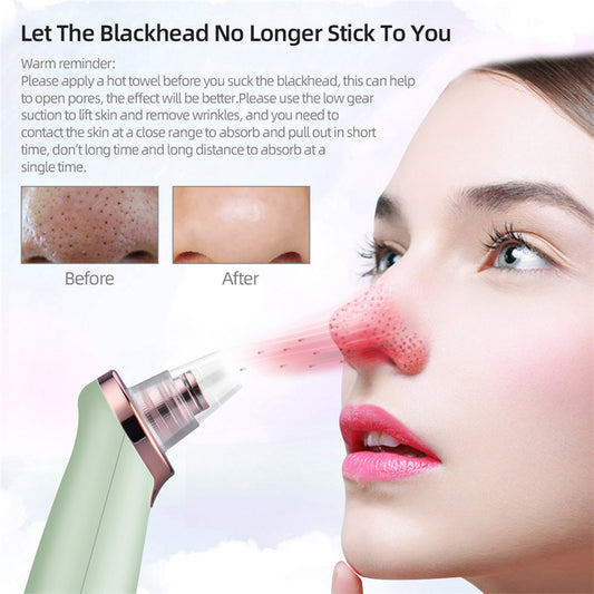 Blackhead Suction Beauty machine Electric blackhead removal pore cleaner Acne exhaler
